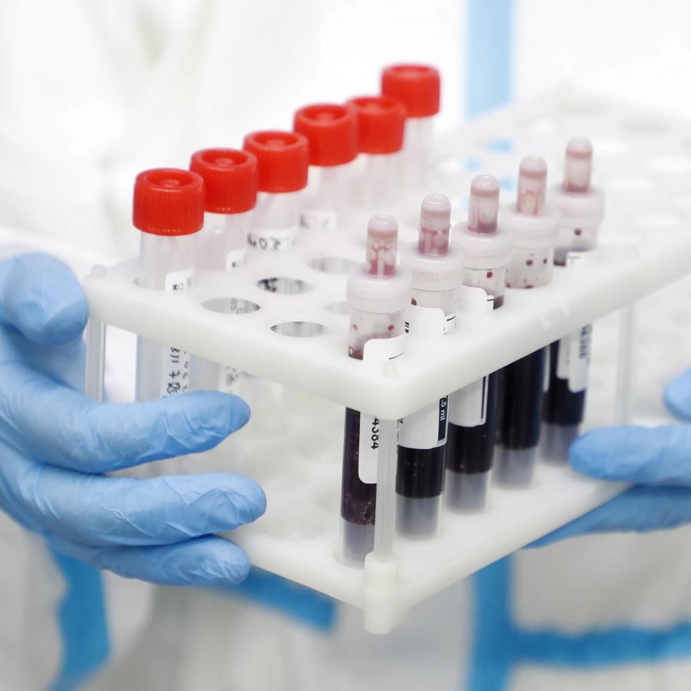 Тест на антитела к COVID-19: быстро и надёжно в Ельцин Центре